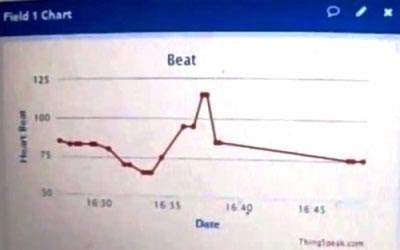 Heart Beat Monitoring over Internet using Arduino and ThingSpeak - source illustration from page 760