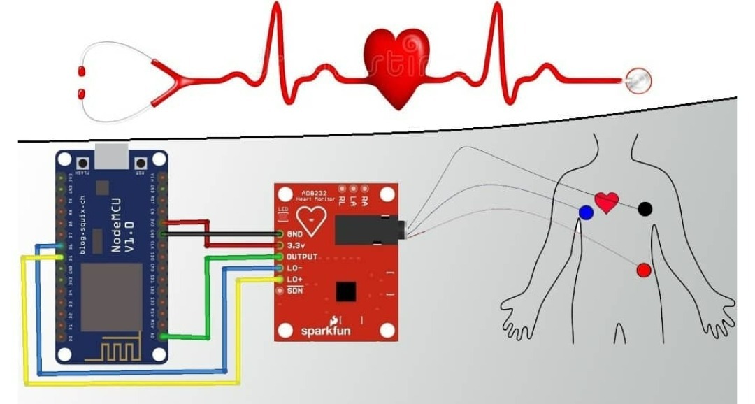 IoT ECG Monitoring with AD8232 ECG Sensor & ESP8266 - source illustration from page 1206